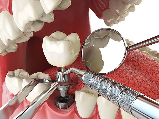 Best Emergency Treatment for Toothache in Brodhead, WI
